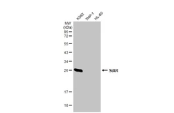 Anti-StAR antibody [HL1362] used in Western Blot (WB). GTX636802