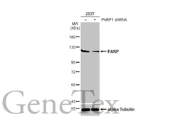 Anti-PARP antibody [HL1364] used in Western Blot (WB). GTX636804