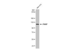 Anti-PARP antibody [HL1364] used in Western Blot (WB). GTX636804