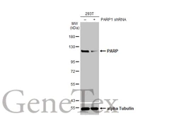 Anti-PARP antibody [HL1365] used in Western Blot (WB). GTX636805
