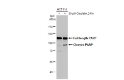 Anti-PARP antibody [HL1365] used in Western Blot (WB). GTX636805