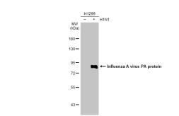 Anti-Influenza A virus PA protein antibody [HL1388] used in Western Blot (WB). GTX636828