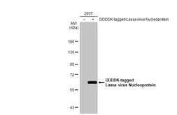 Anti-Lassa virus Nucleoprotein antibody [HL1390] used in Western Blot (WB). GTX636830