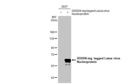Anti-Lassa virus Nucleoprotein antibody [HL1392] used in Western Blot (WB). GTX636832