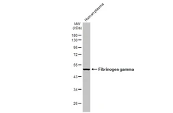 Anti-Fibrinogen gamma antibody [HL1395] used in Western Blot (WB). GTX636835