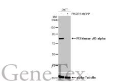 Anti-PI3 kinase p85 alpha antibody [HL1398] used in Western Blot (WB). GTX636838