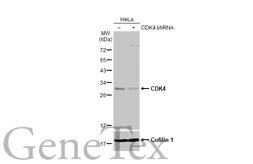 Anti-CDK4 antibody [HL1407] used in Western Blot (WB). GTX636873