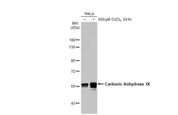 Anti-Carbonic Anhydrase IX antibody [HL1410] used in Western Blot (WB). GTX636876