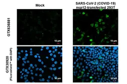 Anti-SARS-CoV-2 (COVID-19) nsp12 antibody [HL1415] used in Immunocytochemistry/ Immunofluorescence (ICC/IF). GTX636881