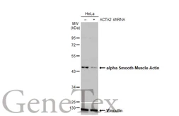 Anti-alpha Smooth Muscle Actin antibody [HL1419] used in Western Blot (WB). GTX636885