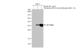 Anti-IL1 beta antibody [HL1421] used in Western Blot (WB). GTX636887