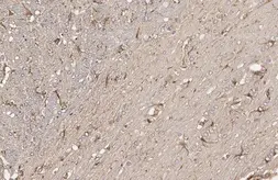 Anti-IL1 beta antibody [HL1421] used in IHC (Paraffin sections) (IHC-P). GTX636887