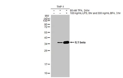 Anti-IL1 beta antibody [HL1421] used in Western Blot (WB). GTX636887