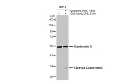 Anti-Gasdermin D antibody [HL1430] used in Western Blot (WB). GTX636896