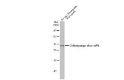 Anti-Chikungunya virus nsP2 antibody [HL1431] used in Western Blot (WB). GTX636897
