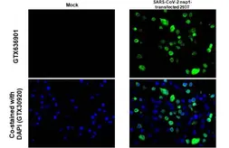 Anti-SARS-CoV-2 (COVID-19) nsp1 antibody [HL1435] used in IHC-P (cell pellet) (IHC-P (cell pellet)). GTX636901