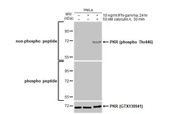 Anti-PKR (phospho Thr446) antibody [HL1439] used in Western Blot (WB). GTX636912