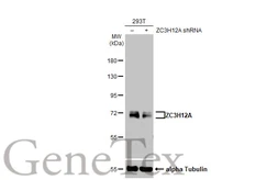 Anti-ZC3H12A antibody [HL1442] used in Western Blot (WB). GTX636914