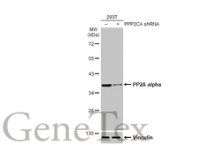Anti-PP2A alpha antibody [HL1447] used in Western Blot (WB). GTX636919