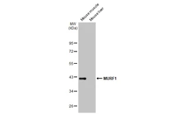 Anti-MURF1 antibody [HL1450] used in Western Blot (WB). GTX636922