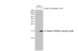 Anti-Histone H3K18ac (Acetyl Lys18) antibody [HL1463] used in Western Blot (WB). GTX636937