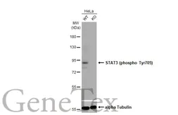 Anti-STAT3 (phospho Tyr705) antibody [HL1464] used in Western Blot (WB). GTX636938