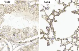 Anti-Her2 / ErbB2 (phospho Tyr1248) antibody [HL1466] used in IHC (Paraffin sections) (IHC-P). GTX636940