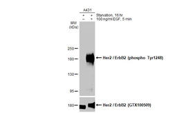 Anti-Her2 / ErbB2 (phospho Tyr1248) antibody [HL1466] used in Western Blot (WB). GTX636940