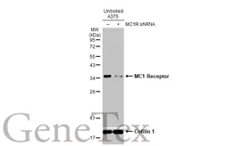 Anti-MC1 Receptor antibody [HL1470] used in Western Blot (WB). GTX636944