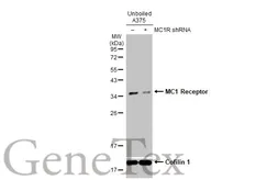 Anti-MC1 Receptor antibody [HL1471] used in Western Blot (WB). GTX636945