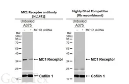 Anti-MC1 Receptor antibody [HL1471] used in Western Blot (WB). GTX636945