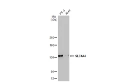 Anti-SLC4A4 antibody [HL1473] used in Western Blot (WB). GTX636947