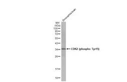 Anti-CDK2 (phospho Tyr15) antibody [HL1474] used in Western Blot (WB). GTX636948