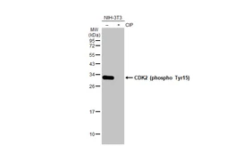 Anti-CDK2 (phospho Tyr15) antibody [HL1474] used in Western Blot (WB). GTX636948