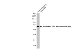 Anti-Influenza B virus Neuraminidase (NA) antibody [HL1476] used in Western Blot (WB). GTX636950