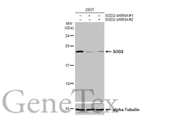 Anti-SOD2 antibody [HL1483] used in Western Blot (WB). GTX636957