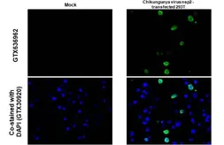 Anti-Chikungunya virus nsP2 antibody [HL1488] used in IHC-P (cell pellet) (IHC-P (cell pellet)). GTX636962