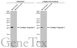 Anti-Cardiac Troponin I antibody [HL1489] used in Western Blot (WB). GTX636963