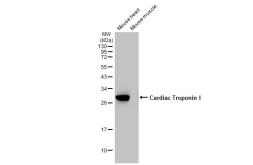 Anti-Cardiac Troponin I antibody [HL1489] used in Western Blot (WB). GTX636963