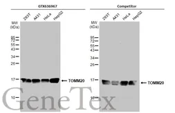 Anti-TOMM20 antibody [HL1493] used in Western Blot (WB). GTX636967