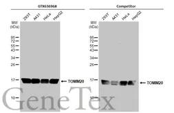 Anti-TOMM20 antibody [HL1494] used in Western Blot (WB). GTX636968