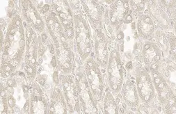 Anti-RAB5A antibody [HL1497] used in IHC (Paraffin sections) (IHC-P). GTX636971