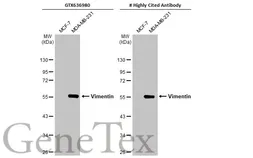 Anti-Vimentin antibody [HL1506] used in Western Blot (WB). GTX636980