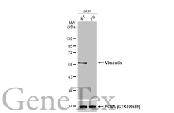 Anti-Vimentin antibody [HL1506] used in Western Blot (WB). GTX636980