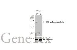 Anti-DNA polymerase beta antibody [HL1512] used in Western Blot (WB). GTX636986