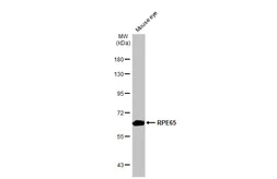 Anti-RPE65 antibody [HL1519] used in Western Blot (WB). GTX636993
