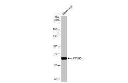 Anti-RPE65 antibody [HL1519] used in Western Blot (WB). GTX636993