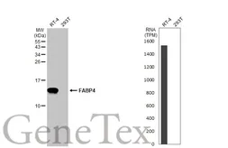 Anti-FABP4 antibody [HL1520] used in Western Blot (WB). GTX636994