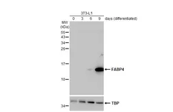 Anti-FABP4 antibody [HL1520] used in Western Blot (WB). GTX636994