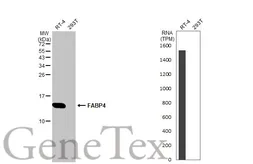 Anti-FABP4 antibody [HL1521] used in Western Blot (WB). GTX636995